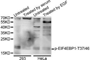 Western blot analysis of extracts of various cells, using Phospho-EIF4EBP1-T37/46 antibody. (eIF4EBP1 antibody  (pThr36))