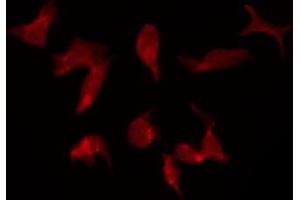 ABIN6275387 staining Hela by IF/ICC. (KCNQ5 antibody  (C-Term))