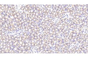 Detection of PRCP in Mouse Kidney Tissue using Polyclonal Antibody to Prolylcarboxypeptidase (PRCP) (PRCP antibody  (AA 169-443))