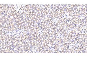 Detection of PRCP in Mouse Kidney Tissue using Polyclonal Antibody to Prolylcarboxypeptidase (PRCP) (PRCP antibody  (AA 169-443))