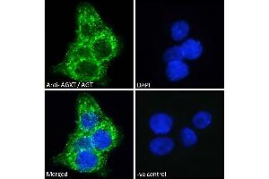 ABIN570702 Immunofluorescence analysis of paraformaldehyde fixed HepG2 cells, permeabilized with 0. (AGXT antibody  (Internal Region))