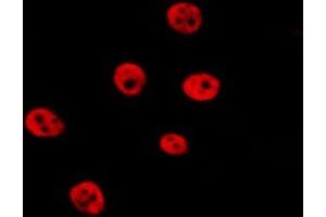 Immunofluorescence (fixed cells) (IF/ICC) image for anti-Janus Kinase 2 (JAK2) (pTyr931) antibody (ABIN6256069)