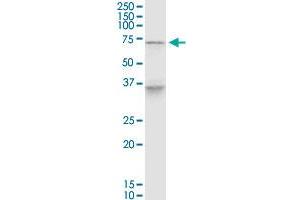 HMX3 monoclonal antibody (M01), clone 1F7. (PELP1 antibody  (AA 337-410))