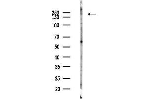 Western blot analysis of lysates from Mouse liver, using HER4 Antibody at 1/1000 dilution.