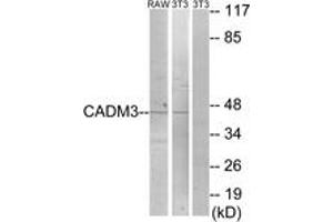 Western Blotting (WB) image for anti-Cell Adhesion Molecule 3 (CADM3) (AA 141-190) antibody (ABIN2889891) (CADM3 antibody  (AA 141-190))