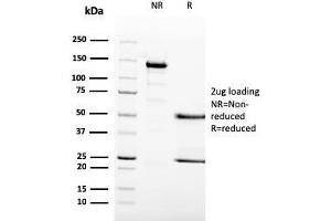 SDS-PAGE Analysis Purified MCM6 Mouse Monoclonal Antibody (MCM6/3000).