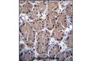 Immunohistochemistry (Paraffin-embedded Sections) (IHC (p)) image for anti-Polymerase (RNA) I Polypeptide B, 128kDa (POLR1B) (AA 89-117), (N-Term) antibody (ABIN656426)