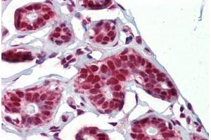 Human Breast (formalin-fixed, paraffin-embedded) stained with NKRF antibody ABIN462215 followed by biotinylated goat anti-rabbit IgG secondary antibody ABIN481713, alkaline phosphatase-streptavidin and chromogen. (NKRF antibody  (C-Term))