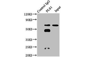Immunoprecipitating PLS1 in 293 whole cell lysate Lane 1: Rabbit control IgG instead of ABIN7163552 in 293 whole cell lysate. (PLS1 antibody  (AA 1-143))