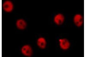 Immunofluorescence (fixed cells) (IF/ICC) image for anti-REL proto-oncogene (c-Rel) (pSer503) antibody (ABIN6255382)