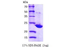 SDS-PAGE (SDS) image for Peroxiredoxin 1 (PRDX1) (AA 1-199) protein (His tag) (ABIN667075)