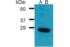 Western Blotting analysis (reducing conditions) of Ramos cell lysateusing two batches of rabbit anti-Grb2 polyclonal (A, B). (GRB2 antibody  (AA 198-217))