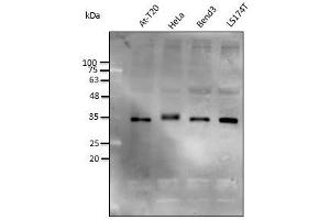 Anti-STUB1 Ab at 1/2,500 dilution, lysates at 50 µg per Iane, rabbit polyclonal to goat lgG (HRP) at 1/10,000 dilution,