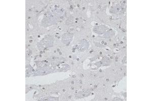 Immunohistochemistry of paraffin-embedded mouse brain using USP7/HAUSP antibody (ABIN6132280, ABIN6150032, ABIN6150034 and ABIN6217614) at dilution of 1:100 (40x lens). (USP7 antibody  (AA 206-1102))