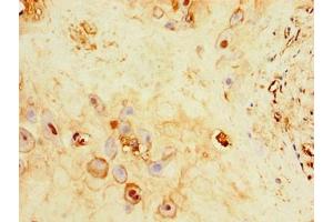 Immunohistochemistry of paraffin-embedded human placenta tissue using ABIN7175013 at dilution of 1:100 (C17orf58 antibody  (AA 21-90))