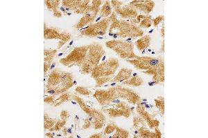 Immunohistochemical analysis of paraffin-embedded H. (AK4 antibody  (AA 119-153))