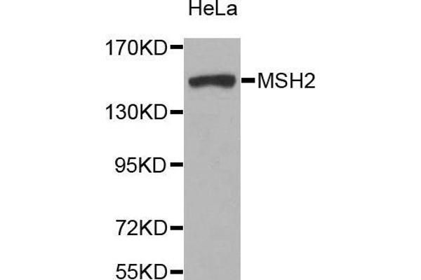 MSH2 抗体  (AA 1-300)