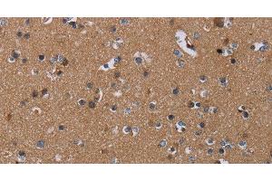 Immunohistochemistry of paraffin-embedded Human brain using PDE4A Polyclonal Antibody at dilution of 1:40 (PDE4A antibody)