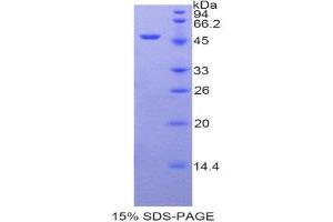 SDS-PAGE (SDS) image for Arrestin, beta 2 (ARRB2) (AA 262-430) protein (His tag,GST tag) (ABIN2122459)