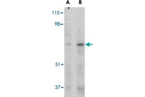 Western blot analysis of MAPKAP1 in human skeletal muscle tissue lysate with MAPKAP1 polyclonal antibody  at (A) 1 and (B) 2 ug/mL . (MAPKAP1 antibody  (Internal Region))