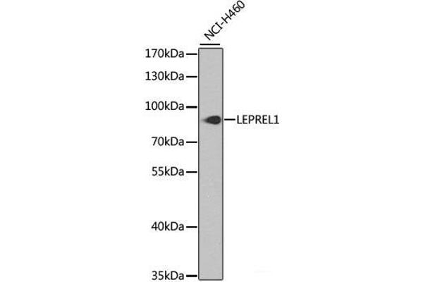 LEPREL1 抗体