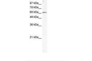 Image no. 1 for anti-Methyltransferase Like 3 (METTL3) (AA 206-255) antibody (ABIN202782) (METTL3 antibody  (AA 206-255))