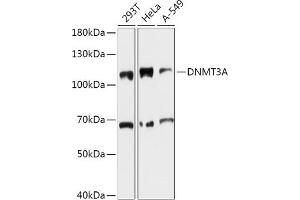 Western blot analysis of extracts of various cell lines, using DNMT3A antibody (ABIN6130284, ABIN6139747, ABIN6139749 and ABIN6215481) at 1:1000 dilution.