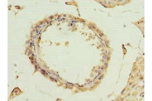 Immunohistochemistry of paraffin-embedded human testis tissue using ABIN7173035 at dilution of 1:100 (TMEM115 antibody  (AA 187-351))