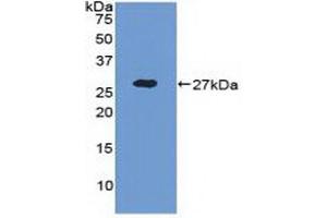 Detection of Recombinant ADAM17, Human using Polyclonal Antibody to A Disintegrin And Metalloprotease 17 (ADAM17) (ADAM17 antibody  (AA 226-473))