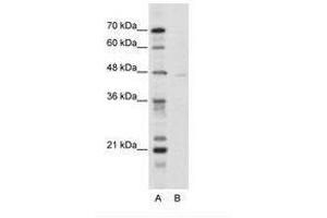 Image no. 1 for anti-Tripartite Motif Containing 38 (TRIM38) (N-Term) antibody (ABIN202589) (TRIM38 antibody  (N-Term))