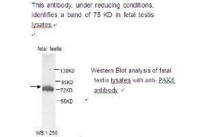 Image no. 1 for anti-P21-Activated Kinase 6 (PAK6) antibody (ABIN790802) (PAK6 antibody)