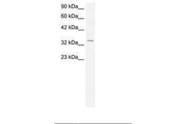 HOXD12 antibody  (N-Term)