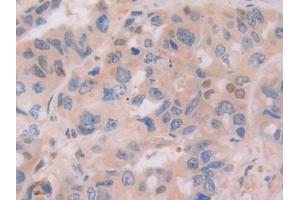 Immunohistochemistry (IHC) image for anti-Interferon, gamma-Inducible Protein 16 (IFI16) (AA 465-671) antibody (ABIN7442042)