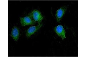 IF analysis of SEZ6L using anti-SEZ6L antibody (ABIN7602260).