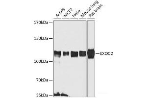 Western blot analysis of extracts of various cell lines using EXOC2 Polyclonal Antibody at dilution of 1:1000. (EXOC2 antibody)