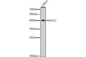 Western blot analysis of extracts of 22Rv1 cells, using KLK11 antibody (ABIN6129403, ABIN6142946, ABIN6142948 and ABIN6216242) at 1:1000 dilution.