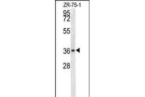 NIT1 Antibody (C-term) (ABIN656966 and ABIN2846150) western blot analysis in ZR-75-1 cell line lysates (35 μg/lane). (Nitrilase 1 antibody  (C-Term))