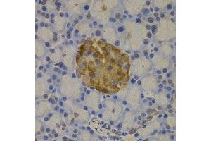Immunohistochemistry of paraffin-embedded rat pancreas using GC antibody at dilution of 1:200 (400x lens). (Gc antibody)