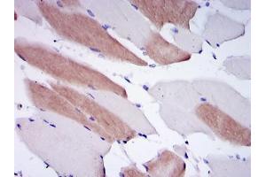 Immunohistochemical analysis of paraffin-embedded human striated muscle tissues using LMNA mouse mAb with DAB staining.