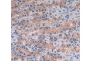Figure. (IL17B antibody  (AA 23-180))