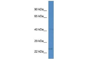 WB Suggested Anti-Slc10a2 Antibody   Titration: 1.