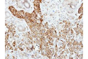 IHC-P Image Immunohistochemical analysis of paraffin-embedded SCM-1 xenograft, using Pancreatic Lipase, antibody at 1:500 dilution. (PNLIP antibody)