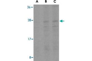 Western blot analysis of BID in A-549 cell lysates with BID polyclonal antibody  at (A) 0. (BID antibody  (Internal Region))