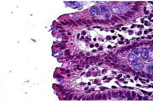Immunohistochemistry (Formalin-fixed Paraffin-embedded Sections) (IHC (fp)) image for anti-Leo1, Paf1/RNA Polymerase II Complex Component, Homolog (S. Cerevisiae) (LEO1) (AA 550-600) antibody (ABIN768836)
