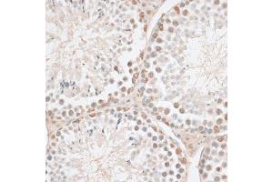 Immunohistochemistry of paraffin-embedded mouse testis using HMGN1 antibody. (HMGN1 antibody)