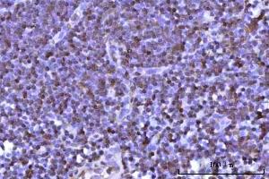 IHC analysis of RNF34 using anti-RNF34 antibody (ABIN7602457).