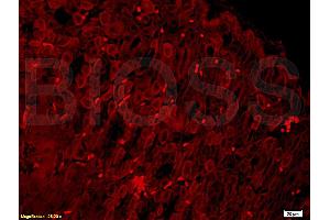 Formalin-fixed and paraffin embedded mouse stomach tissue labeled with Anti- PHOSPHO-PI3KCA(TYR317) Polyclonal Antibody, Unconjugated (ABIN711521) at 1:200 followed by conjugation to the secondary antibody Goat Anti-Rabbit IgG, PE conjugated used at 1:200 dilution for 40 minutes at 37 °C and DAPI staining (PIK3CA antibody  (pTyr317))