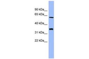 HECA antibody  (AA 359-408)