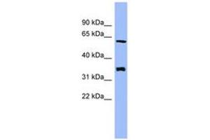 Image no. 1 for anti-Headcase Homolog (HECA) (AA 359-408) antibody (ABIN6744096) (HECA antibody  (AA 359-408))