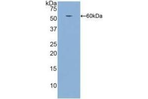 Detection of Recombinant ITGb1, Human using Polyclonal Antibody to Integrin Beta 1 (ITGb1) (ITGB1 antibody  (AA 140-383))